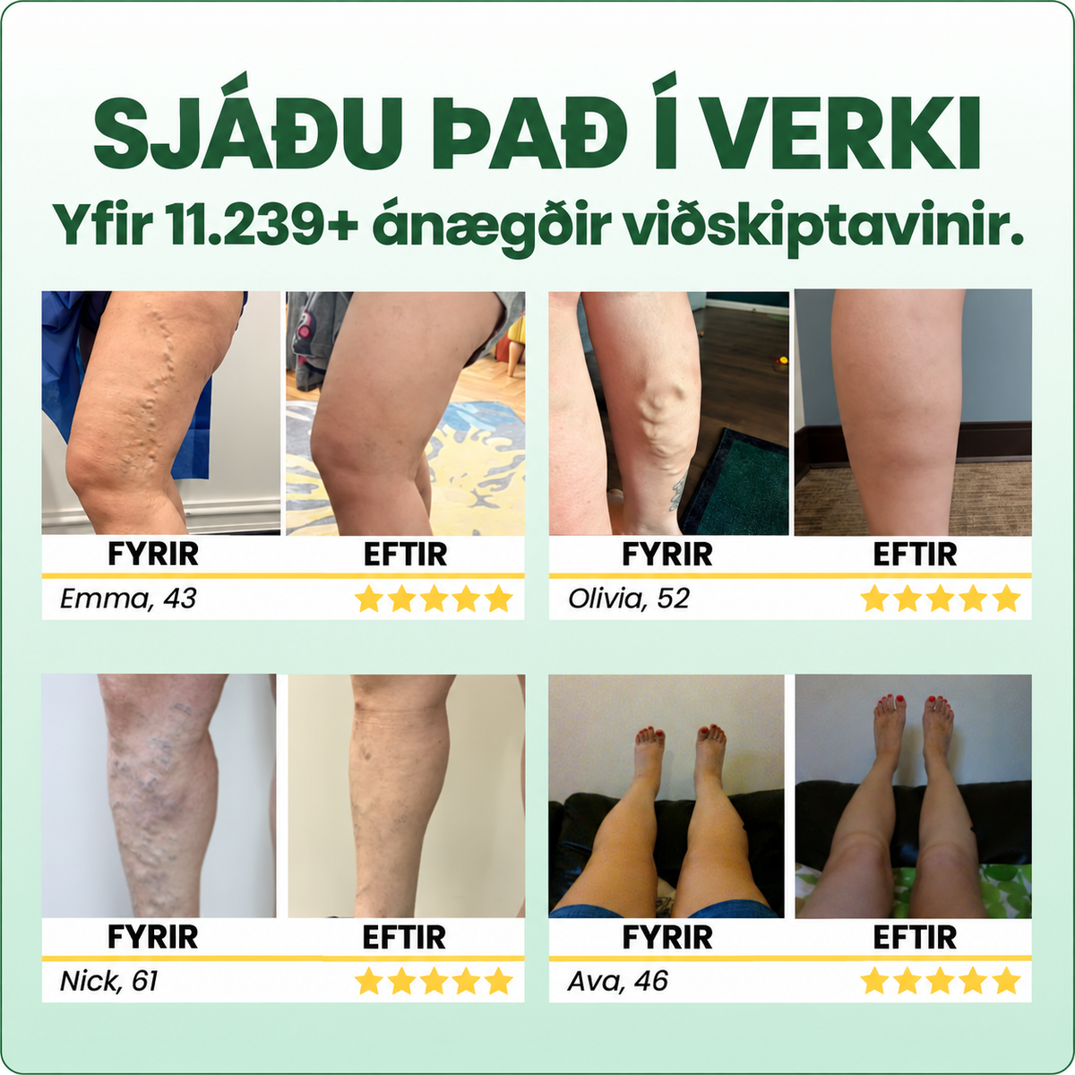 Balzam na nohy proti kŕčovým žilám